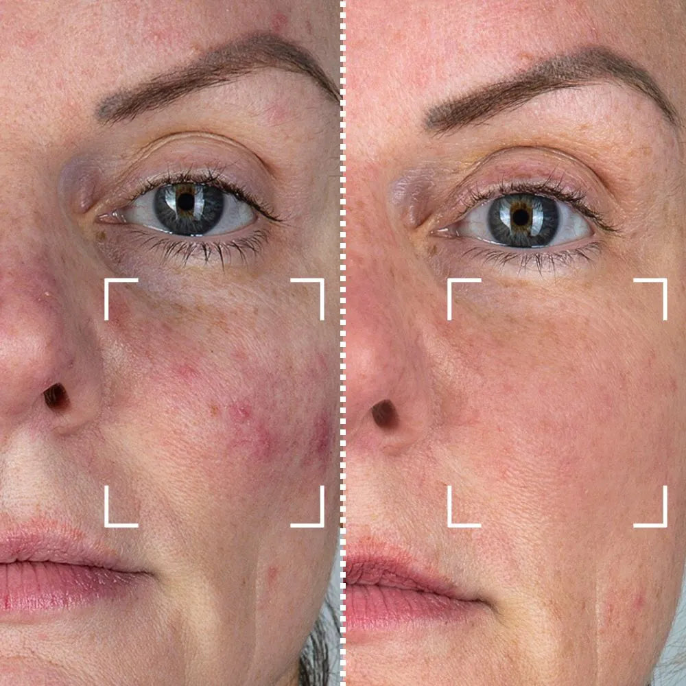 Week 1 → Week 12  transformation period